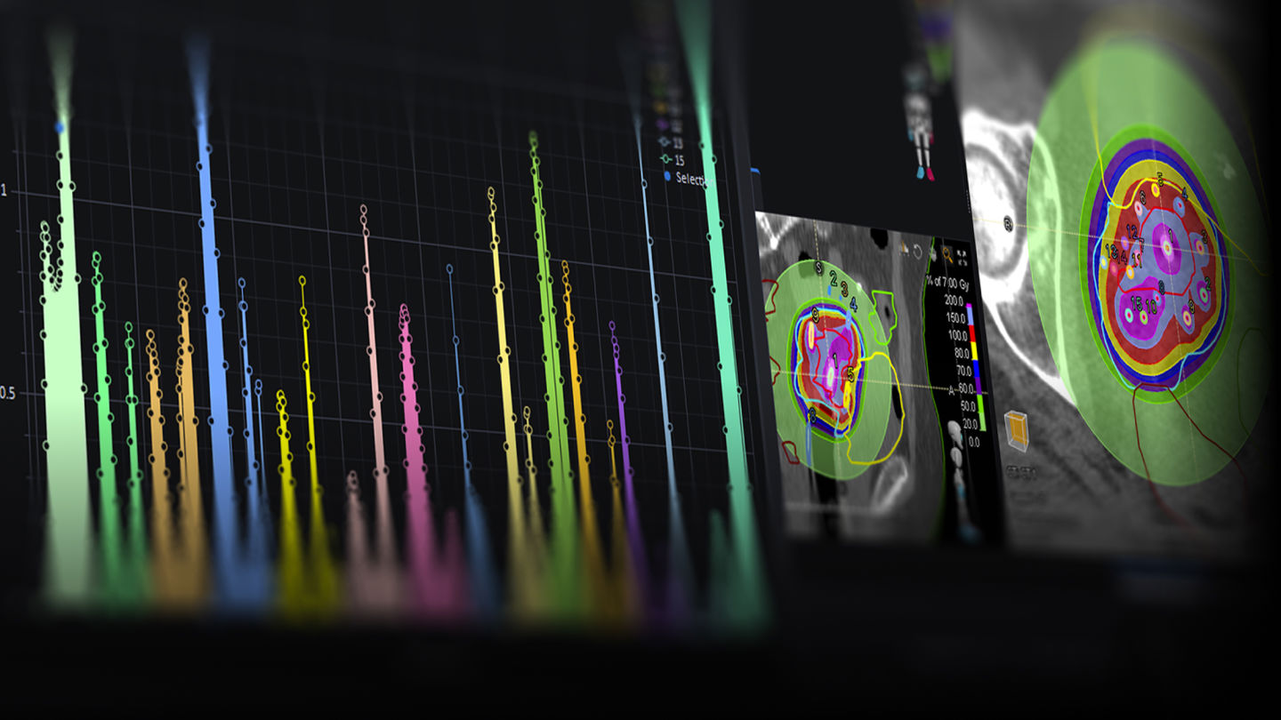 Ray Statio RayStation v2026 | RaySearch Laboratories