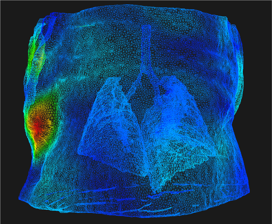Deformable registration Micro RayStation.png
