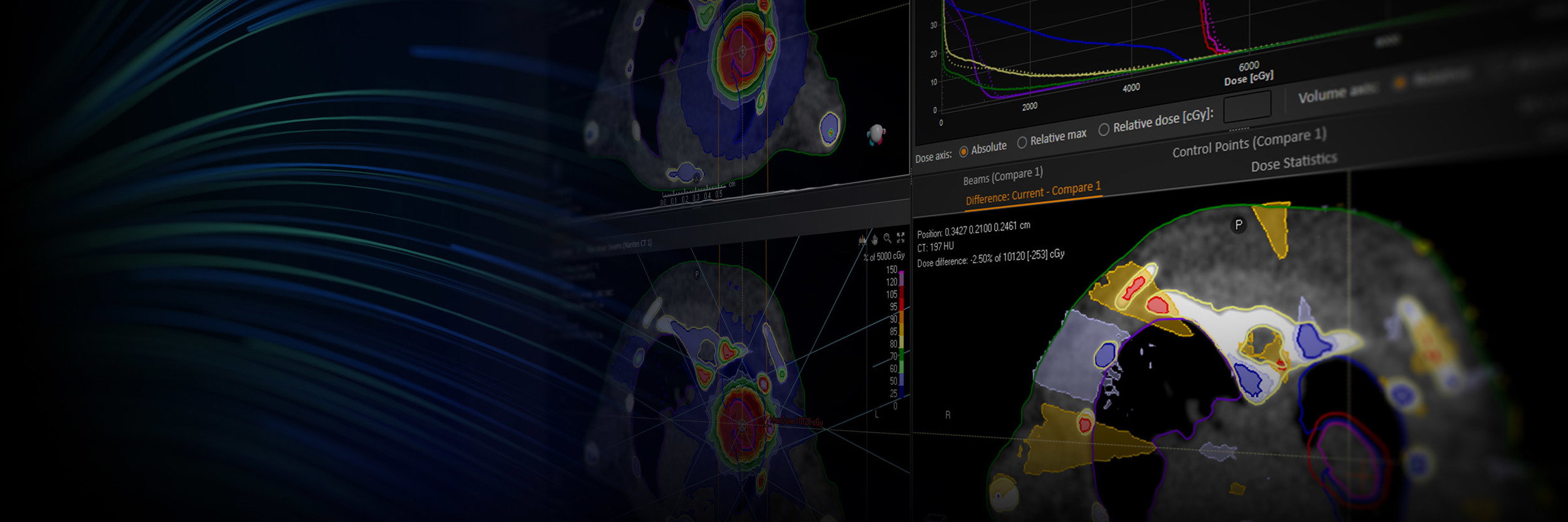 Raysearch Pro Micro RayStation | RaySearch Laboratories