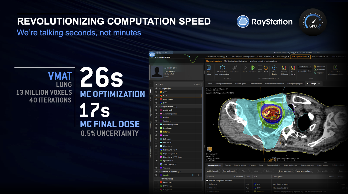 Vmat Solar VMAT Planning in RayStation - Fast and flexible treatment | RaySearch ...