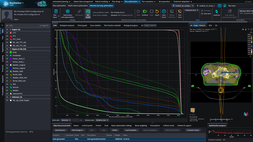 Ray Statio RayStation v2025 | RaySearch Laboratories