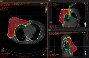 Figure 1: Original treatment plan