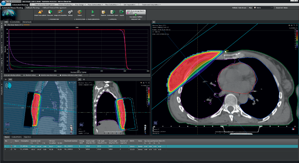 The automated breast planning module workspace