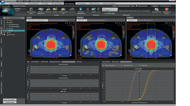 Ray Statio Biological optimization in RayStation | RaySearch Laboratories