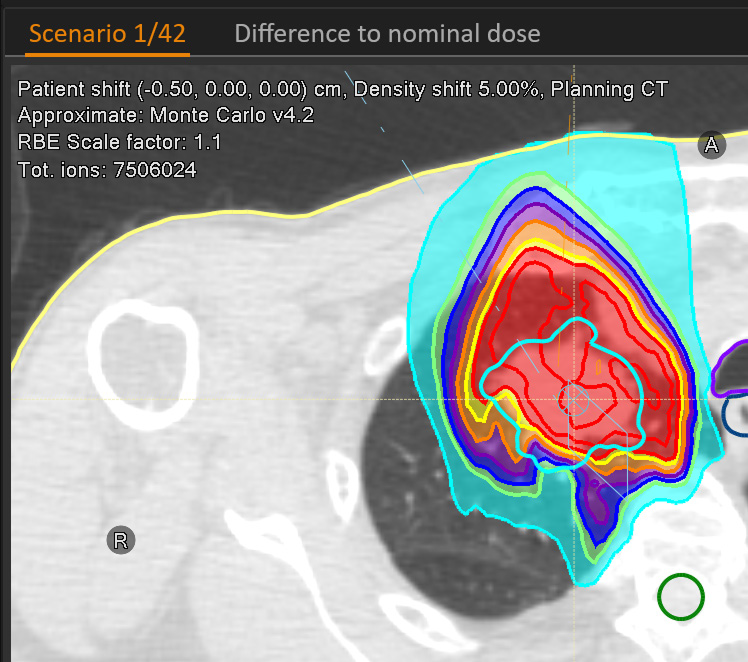 Dose distribution for a single scenario