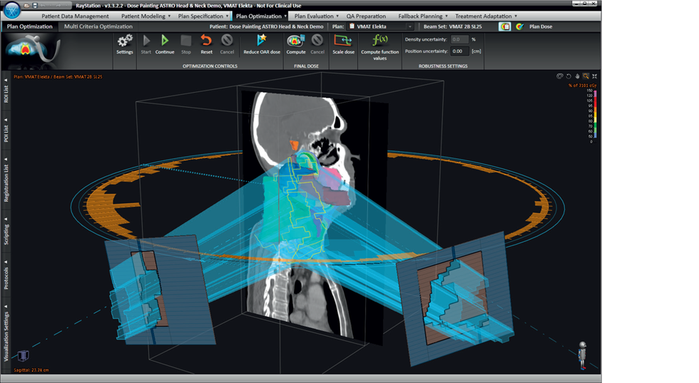 Ray Statio VMAT optimization in RayStation | RaySearch Laboratories